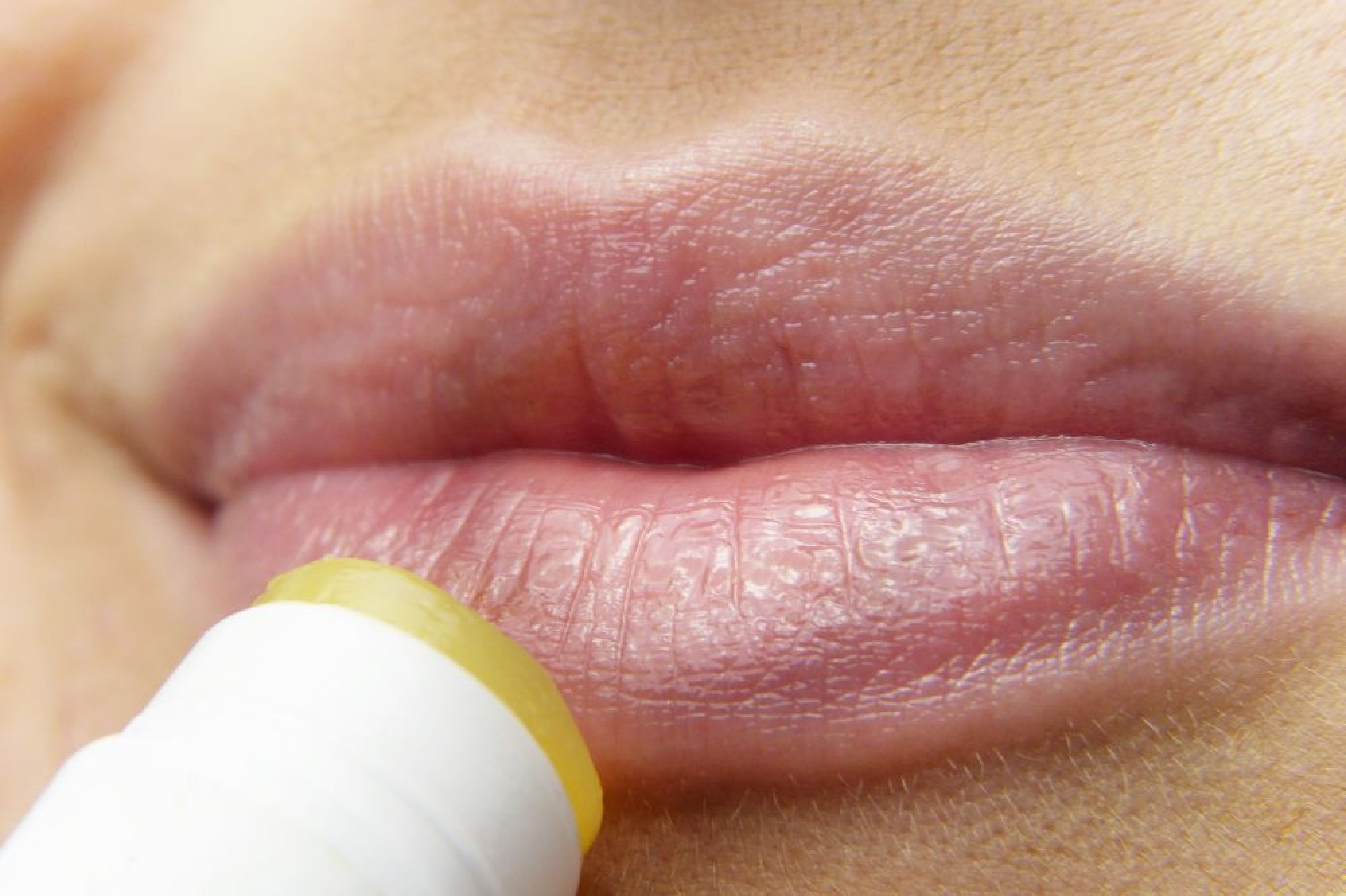 ilustrasi lip plumper 2 - Beautyversity.jpg